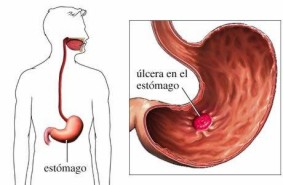 enfermedadescausas010