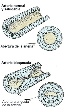 colesterol001