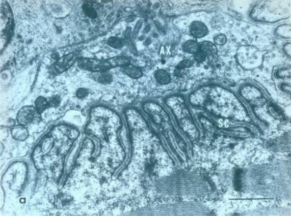neurona014