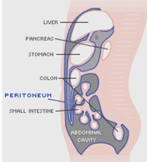 peritoneo007